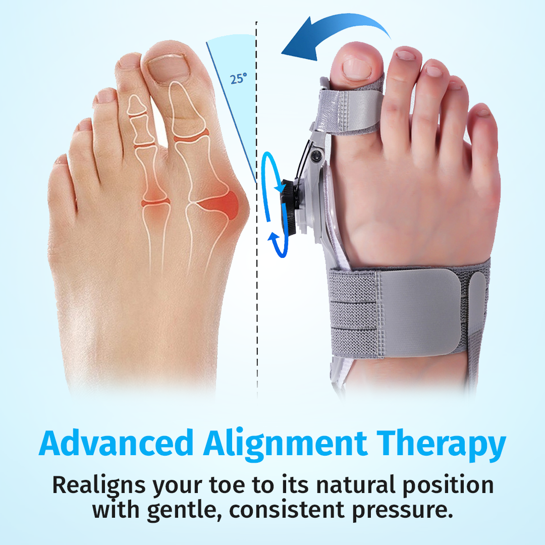 Bunion_Fix_Tech_Highlight_Advanced_Alignment_Therapy_1800x1800